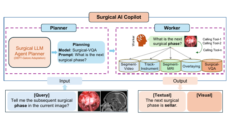Surgical AI Copilot research preview
